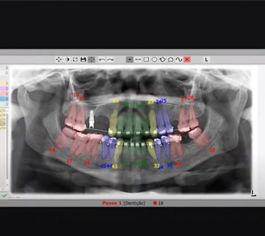 Empresa mineira apresenta software com IA inédito  na maior feira anual de Odontologia do país